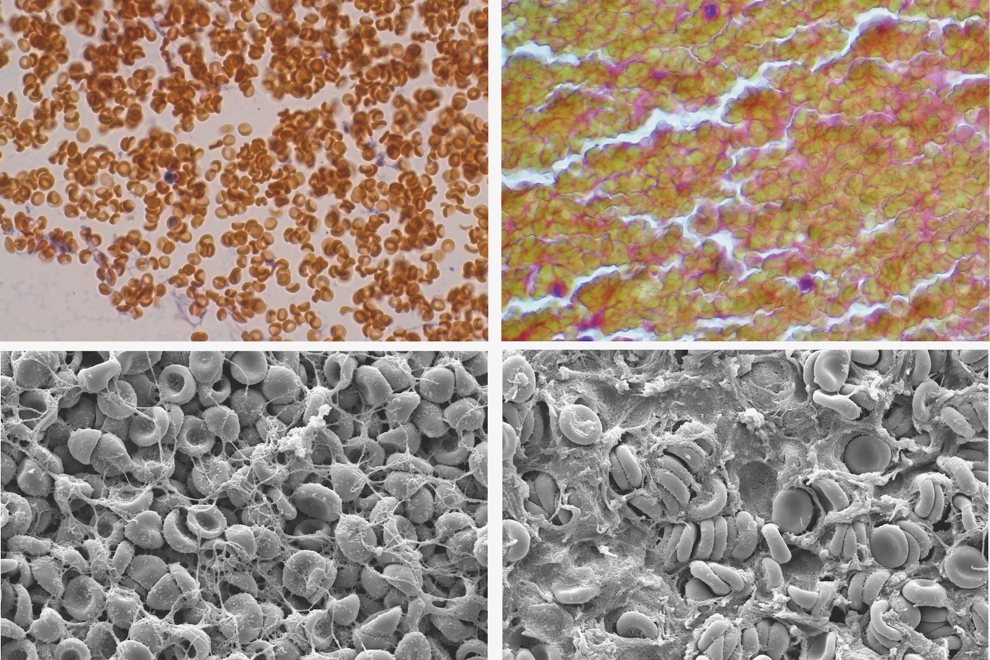 Four panels show a series of close-ups of red blood cells, compacting over time into clots despite the absence of platelets.