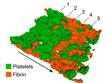 Coagulation