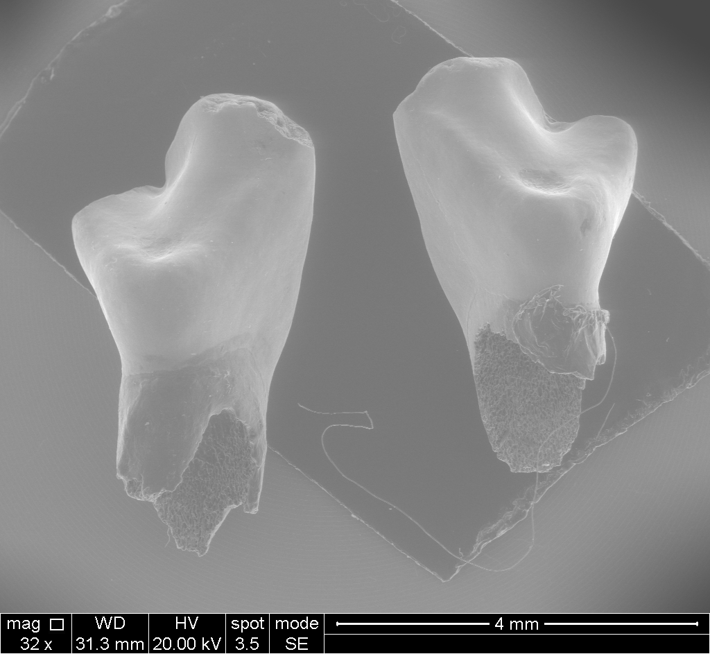 Juno's Milk Teeth
