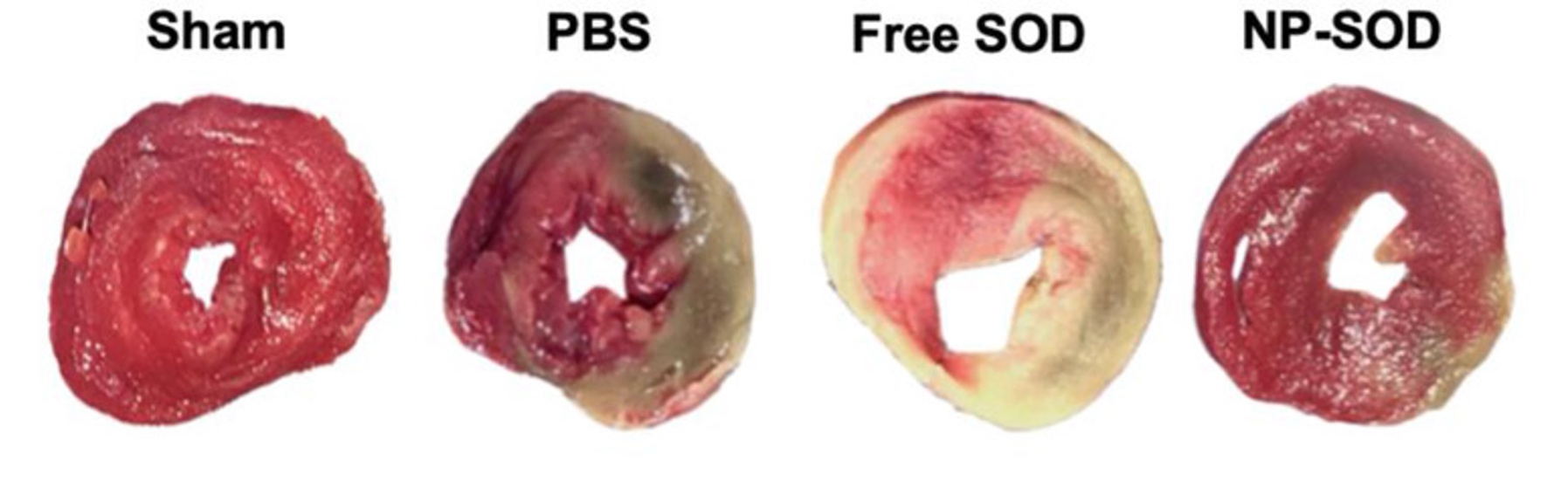 A close up of a donut
Description automatically generated